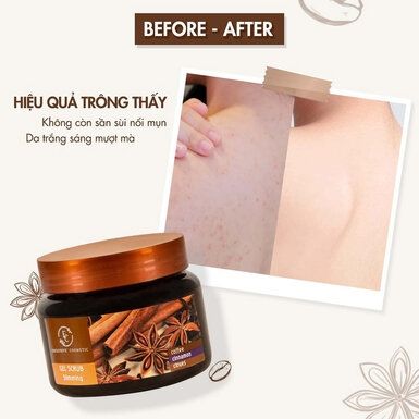 Tẩy Da Chết Toàn Thân Exclusive Cosmetic Quế Hồi Cafe 380g Gel Scrub Coffee & Cinnamon Cloves