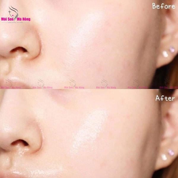 Kem Dưỡng Cocoon Dạng Thạch Bí Đao Giảm Dầu & Mụn 30ml Winter Melon Gel Cream