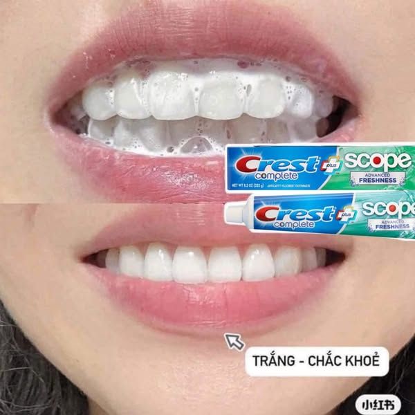 Kem Đánh Răng Crest 3D White Complete Scope Mỹ 232g