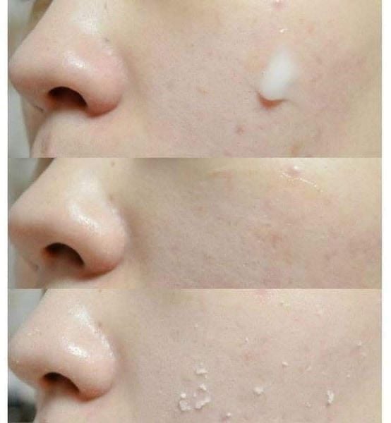 Gel Tẩy Tế Bào Chết Arrahan Chiết Xuất Thảo Mộc 180ml Hanbang Arrahan Soo Peeling Gel
