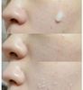 Gel Tẩy Tế Bào Chết Arrahan Chiết Xuất Thảo Mộc 180ml Hanbang Arrahan Soo Peeling Gel