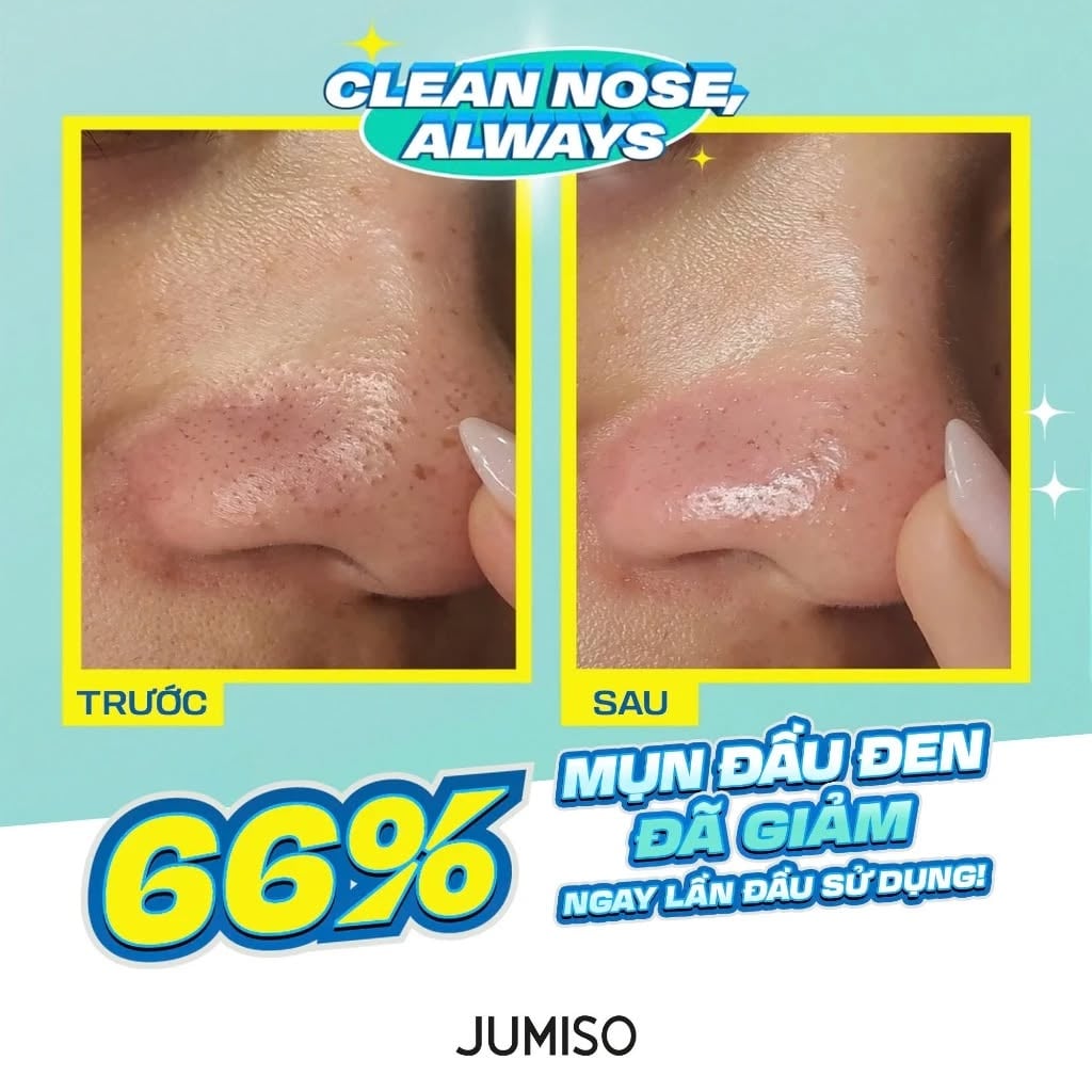 Dung Dịch Jumiso Làm Mềm Mụn Đầu Đen 150ml Blackhead Melting Softener
