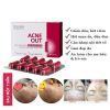 Viên Uống Trị Mụn Biotrade Acnaut Food Supplement With Brewer’s Yeast 30 Viên