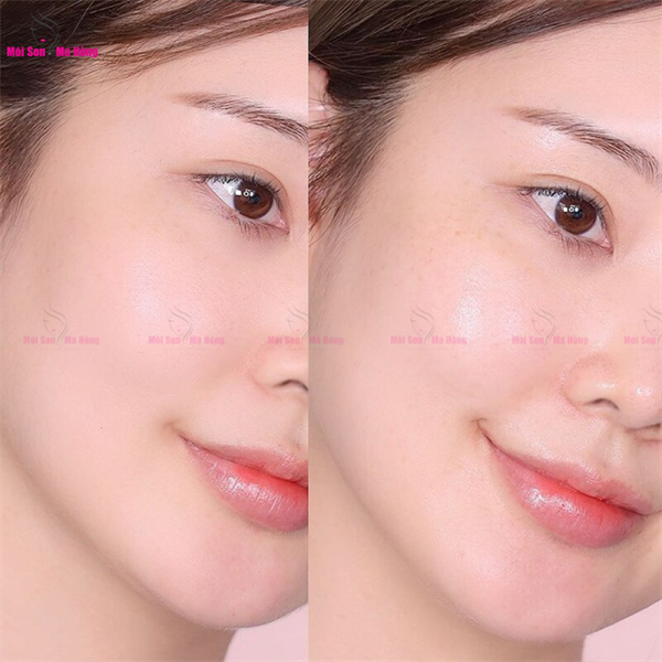 Gel Dưỡng Clinique Dramatically Different Moisturizing Gel 50ml/ 125ml