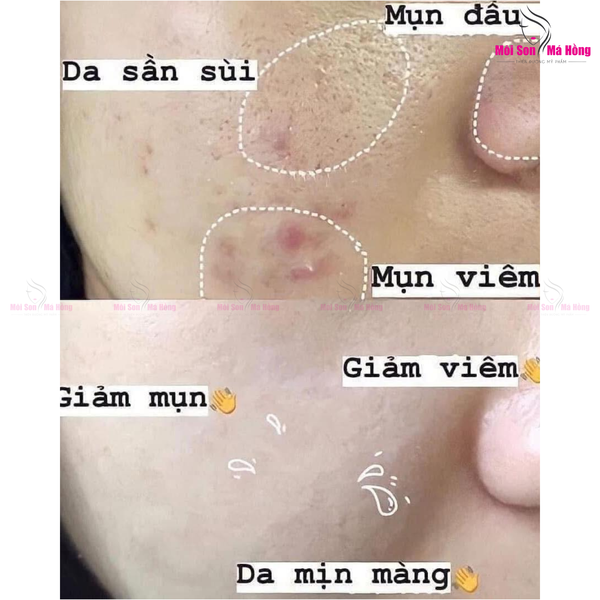 Nước hoa hồng tẩy da chết AHA The Ordinary Glycolic Acid 7% Exfoliating Toner 100ml / 240ml