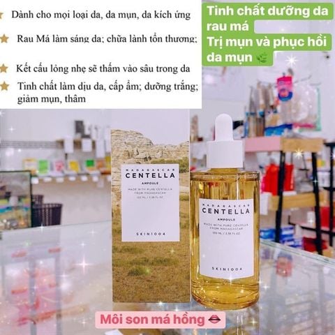 Tinh Chất Rau Má Skin1004 Hỗ Trợ Giảm Mụn, Phục Hồi Da 100ml