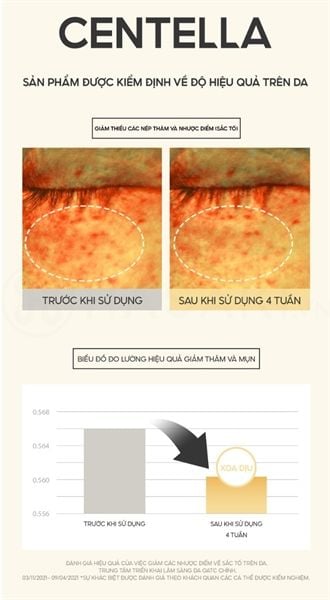 Serum Dr.Pepti Dưỡng Sáng, Cải Thiện Nếp Nhăn 30ml Centella Dark Spot Solution Ampoule