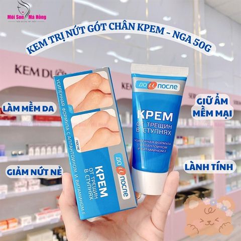 Kem chống nứt nẻ gót chân Kpem TEMA 50ml - Nga