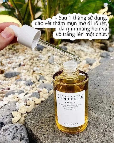 Tinh Chất Skin1004 Madagascar Centella Ampoule Rau Má Giảm Mụn Phục Hồi Da 30ml/ 55ml