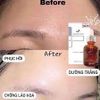 Serum GoodnDoc Dưỡng Ẩm, Hỗ Trợ Phục Hồi Da 30ml Hydra B5 Serum