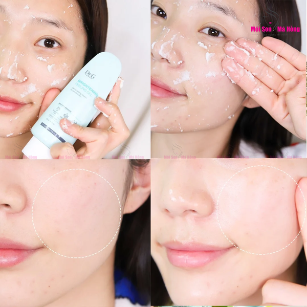 Gel Tẩy Da Chết Làm Sáng Da Dr.G Brightening Peeling Gel 30g/ 120g