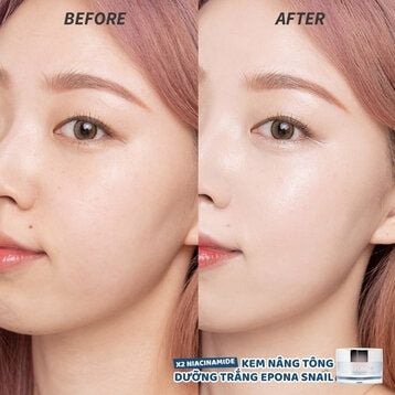 Kem dưỡng Epona Premium Snail Tone Up Cream 50ML