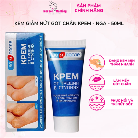 Kem chống nứt nẻ gót chân Kpem TEMA 50ml - Nga