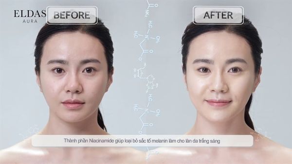 (CÔNG TY) Tinh Chất Tế Bào Gốc Eldas Aura Shine Gold Pearl Premium Peptide All In One 100ml