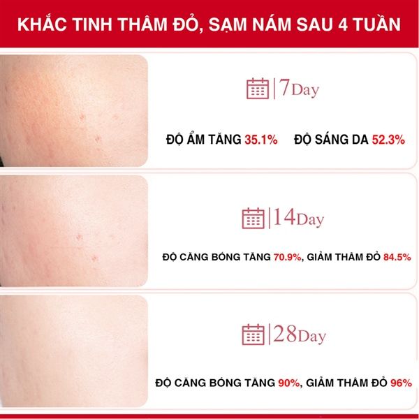 Serum Angel's Liquid Xoá Thâm Đỏ Mờ Sạm Nám 30ml Tranexamic Mela Ampoule