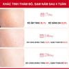 Serum Angel's Liquid Xoá Thâm Đỏ Mờ Sạm Nám 30ml Tranexamic Mela Ampoule