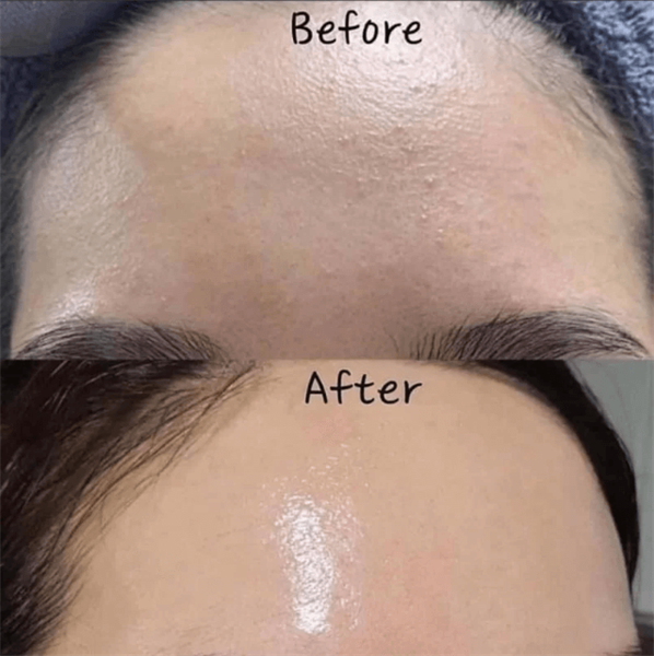 Kem Dưỡng K Lady Care 0.5% Retinol Tái Tạo Da 30ml Premium Retinol Elastin Cream