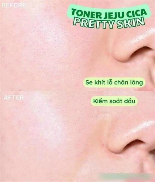 Nước Hoa Hồng Rau Má Prettyskin The Pure Jeju Cica 100 Toner 250ml