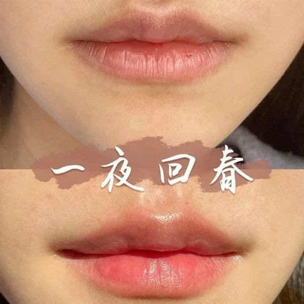 Son Dưỡng Vaseline Lip Therapy Cherry Blush 4.8g