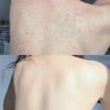 Xịt Giảm Mụn Lưng Pelican For Back Medicated Body Lotion 100ml