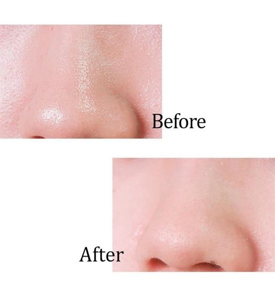 Mặt Nạ Đất Sét Thu Nhỏ Lỗ Chân Lông, Điều Tiết Dầu Thừa Aperire Spa Relief BE FROZEN Pore Mask 120g