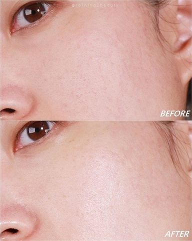 Nước Hoa Hồng Klairs Supple Preparation Unscented Toner Không Mùi 30ml