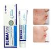 Gel Dưỡng Alcom DERMA FORTE Hỗ Trợ Giảm Mụn, Giảm Thâm 15g