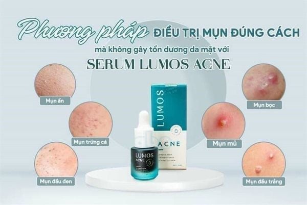 TINH CHẤT TRỊ MỤN LUMOS ACNE 5ML