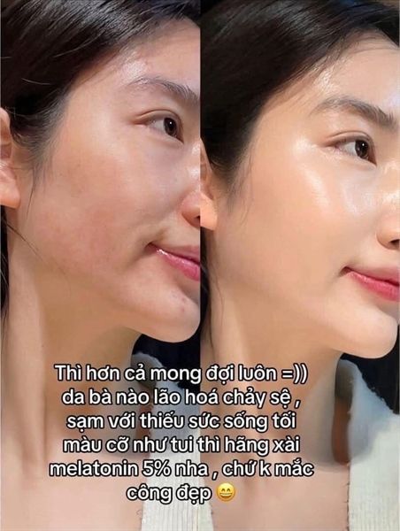 Kem Dưỡng Mờ Nám, Chống Lão Hóa Melatonin Liposome 5% Maxclinic Time Return Cream 50g