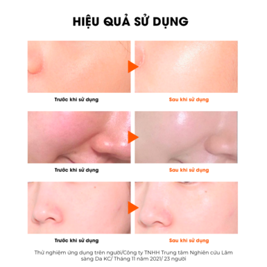 Mặt Nạ Sur.Medic+ Cung Cấp Multi Vitamin 30g Age Control Multi Vita Mask