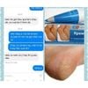Kem chống nứt nẻ gót chân Kpem TEMA 50ml - Nga
