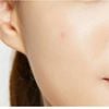 Miếng Dán Mụn Cosrx Che Mụn Hiệu Quả, Siêu Mỏng 18 Miếng Clear Fit Master Patch
