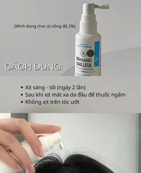 Xịt kích thich mọc tóc Minoxidil 2% Bailleul - 60ml
