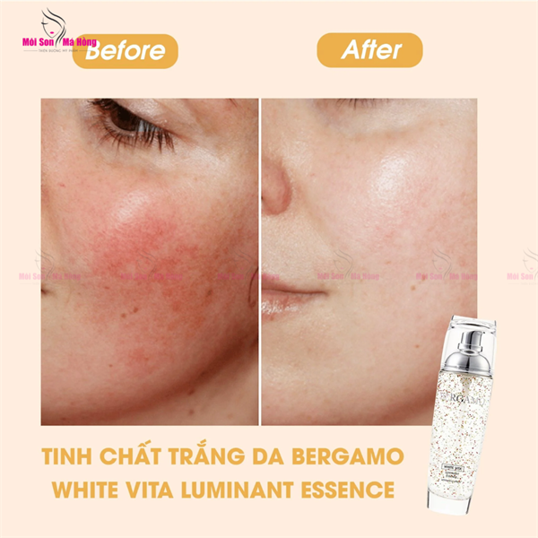 Tinh chất Dưỡng Trắng Bergamo White Vita Luminant Essence (110ml)