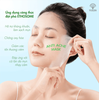 Mặt Nạ Giảm Mụn Yuejin Anti Acne 25ML