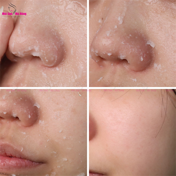 Tẩy Tế Bào Chết Innisfree Green Barley Mild Peeling Gel 120ml