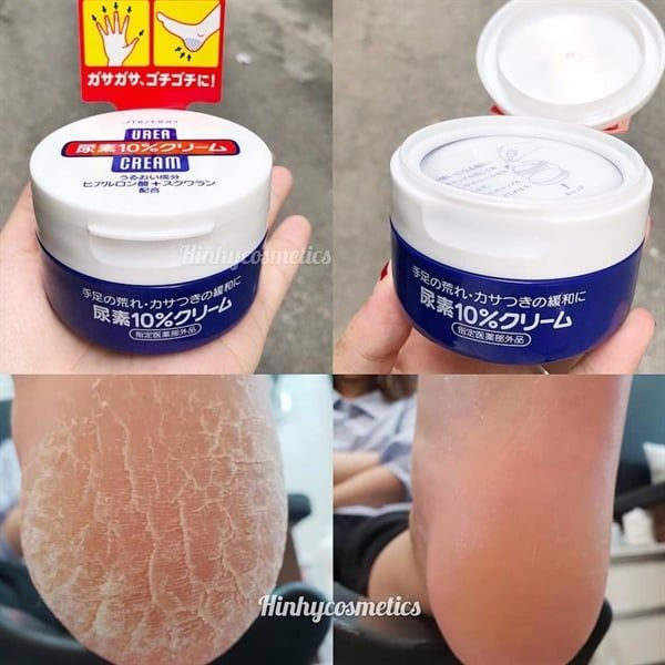 Kem dưỡng trị nứt nẻ tay gót chân Shiseido Urea Cream 10% 100g