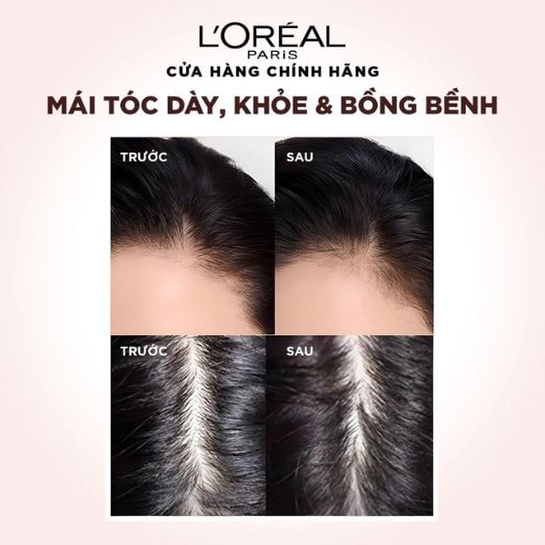 Gội Xả L'Oreal Giảm Gãy Rụng Tóc Giúp Tóc Chắc Khỏe 440mlx2 Elseve Full Resist Anti Hair Fall Shampoo & Conditioner
