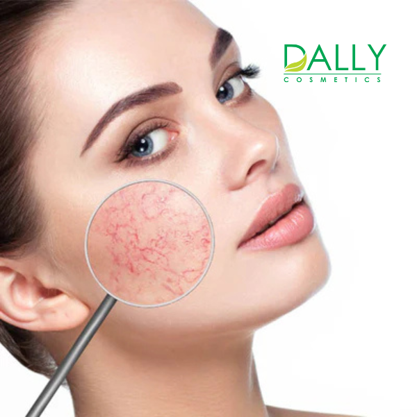  Phục hồi tái tạo nuôi dưỡng da mỏng yếu 