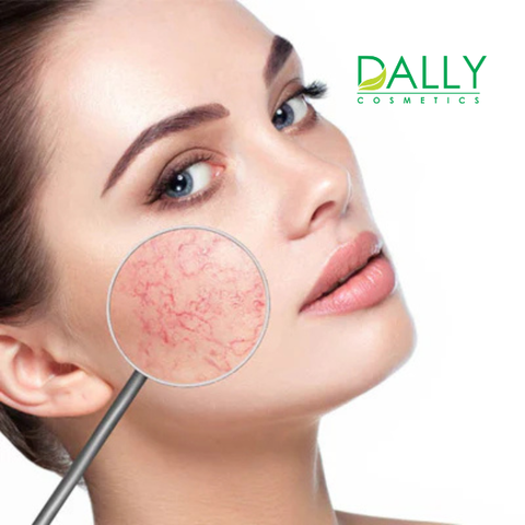  Phục hồi tái tạo nuôi dưỡng da mỏng yếu 