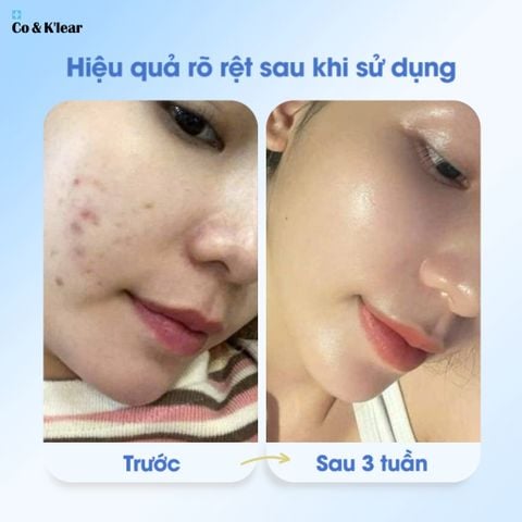  Co&K'lear Bakuchiol 2% Cream Bifida Ferment & Retinol Chống Lão Hóa, Phục Hồi Da 