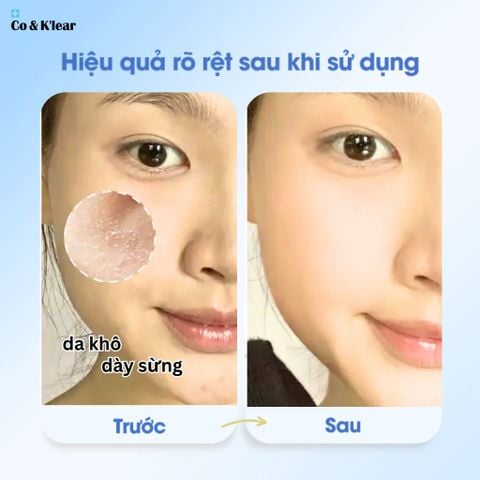  Co&K'lear B5 HA Kombucha Detox Mask Phục Hồi & Dưỡng Ẩm 