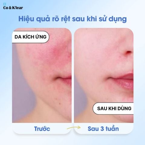  Co&K'lear B3+B5 Collagen Repair Cream Dưỡng Ẩm & Chống Lão Hóa 