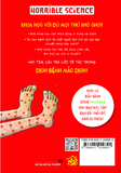  Horrible Science: Dịch Bệnh Mắc Dịch - Nick Arnold; Minh họa: Tony De Saulles 