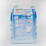 Tã dán Moony size NB 90 miếng (Dưới 5 kg)
