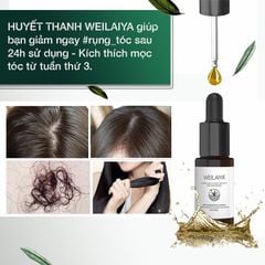 Serum Kích Mọc Và Làm Dày Tóc Weilaiya Ginger Hair Root Nourishing Essence (Hộp 8 lọ 5ml)