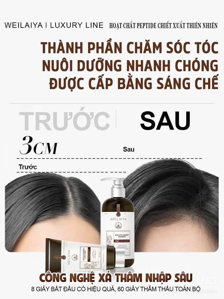 Cặp Gội Xả Gừng Detox - Gừng Thảo Mộc Weilaiya Luxury - Phiên bản mới hiệu quả mọc tóc X2 lần