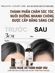 Cặp Gội Xả Gừng Detox - Gừng Thảo Mộc Weilaiya Luxury - Phiên bản mới hiệu quả mọc tóc X2 lần