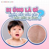  Gói khám dị ứng chuyên sâu toàn diện cho trẻ 