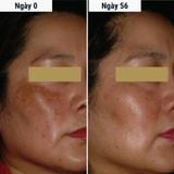 Kem Chống Nắng 4 Trong 1 DermEden Day Cream Global Action Combination Skin SPF 50 PA+++